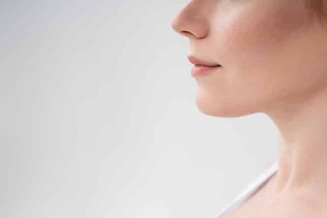 chin implant